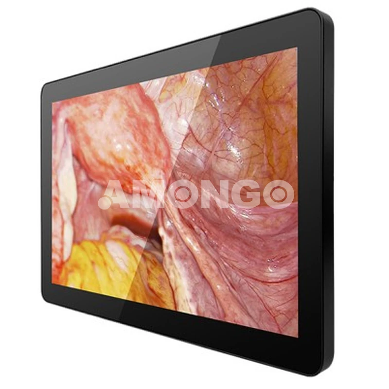 AMG 15 OPTD01G1 Medizinische Anzeige Hersteller